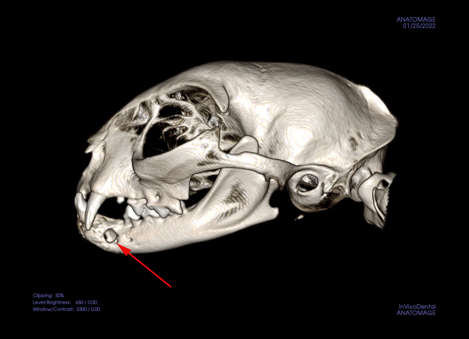 cone-beam CT 3D recon image