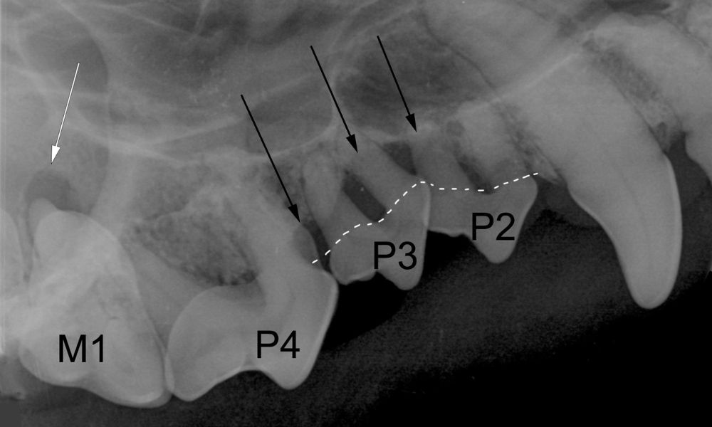 an x - ray of a tooth with arrows pointing to it